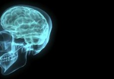 880737_brain_001